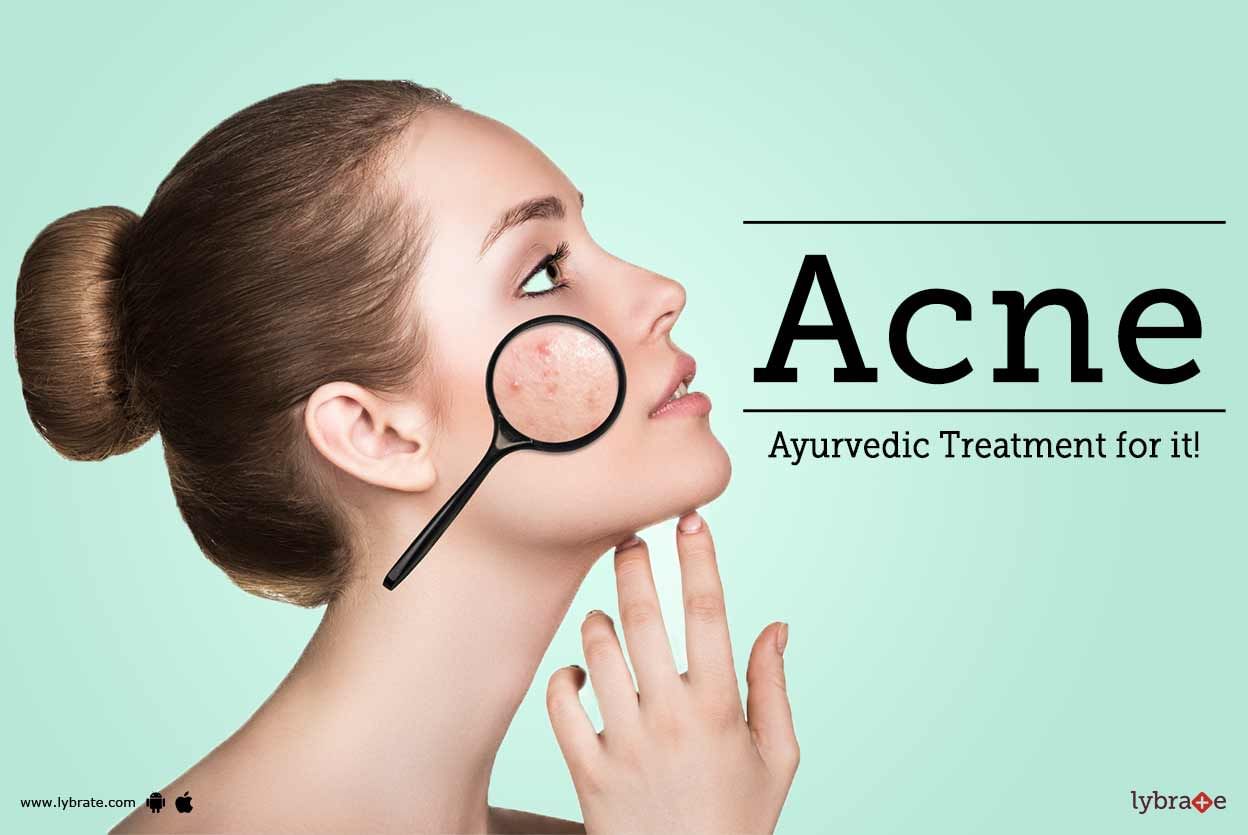 Acne - Ayurvedic Treatment for it!