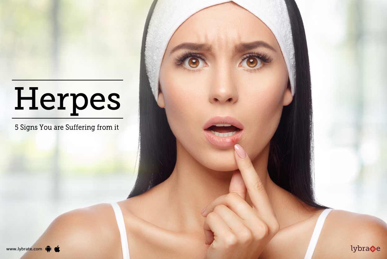 Herpes - 5 Signs You are Suffering from it