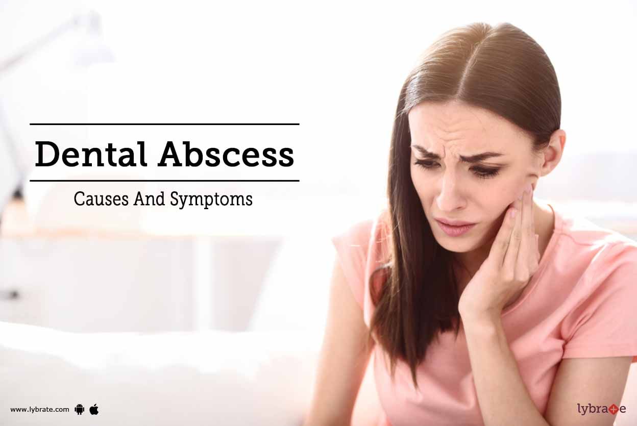 Dental Abscess - Causes And Symptoms