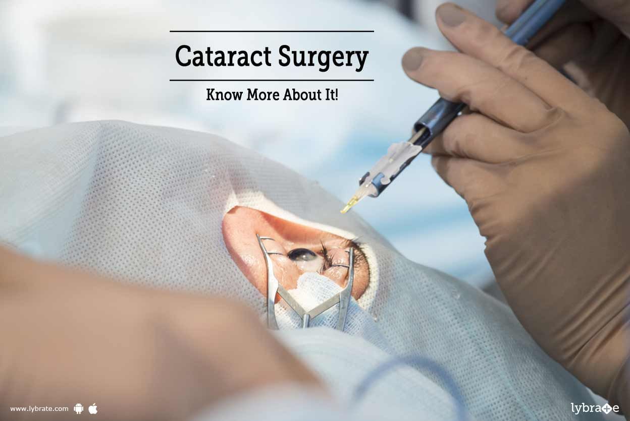 Cataract Surgery - Know More About It!