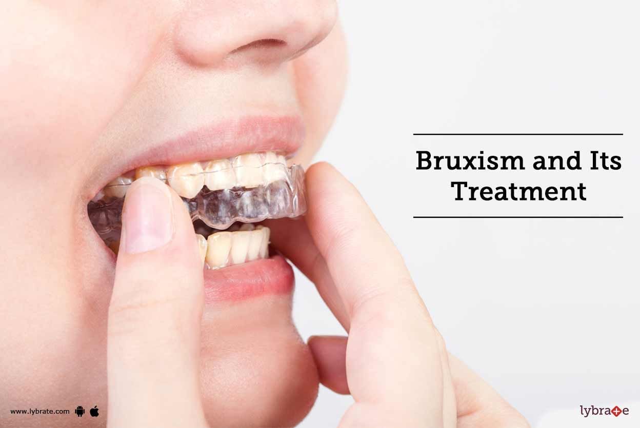 Bruxism and Its Treatment