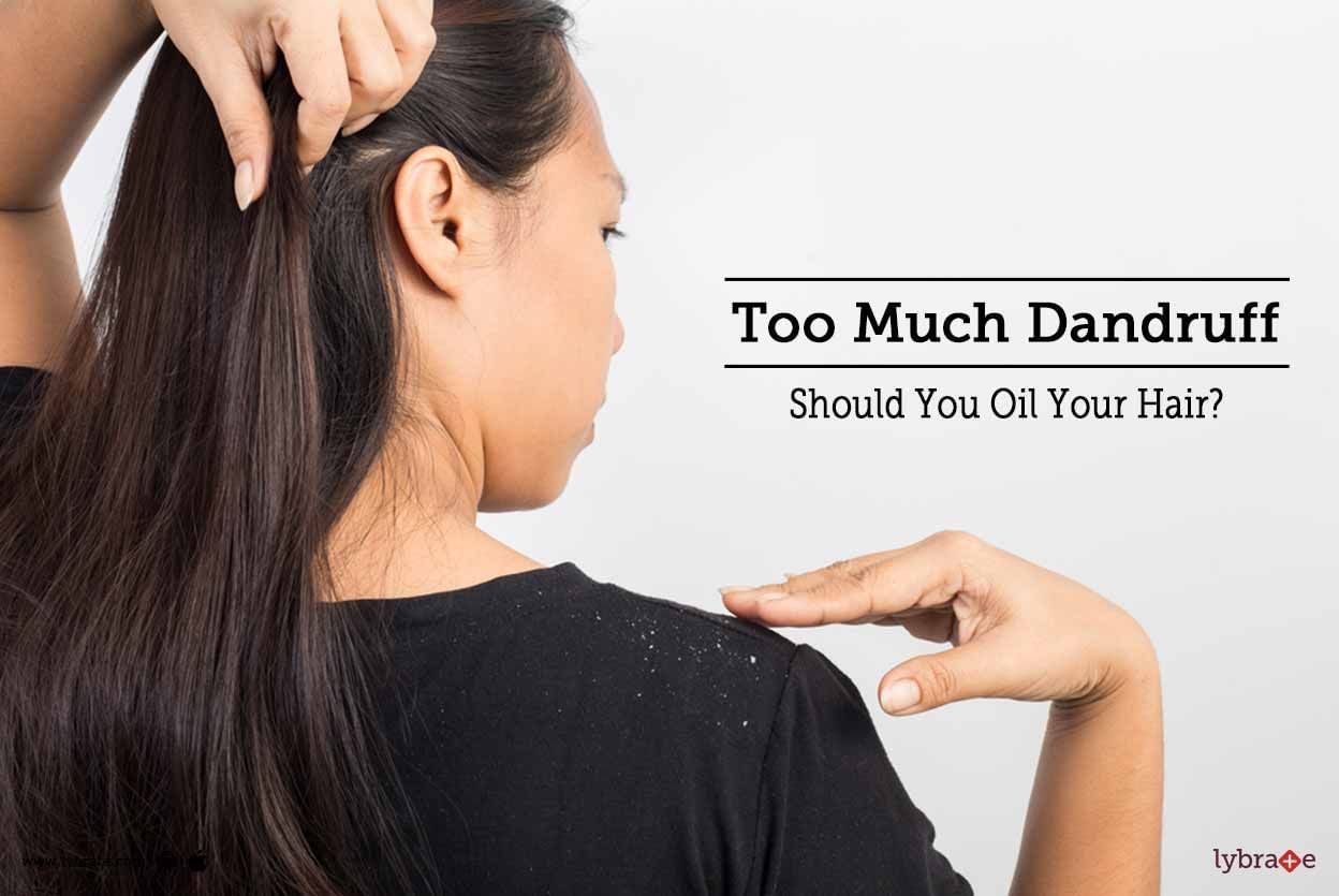 Too Much Dandruff - Should You Oil Your Hair?