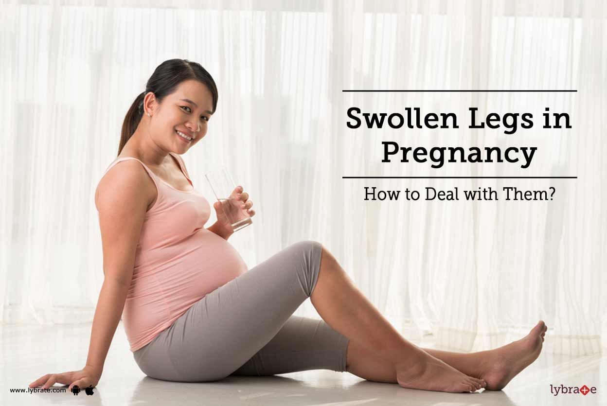 Swollen Legs in Pregnancy - How to Deal with Them?