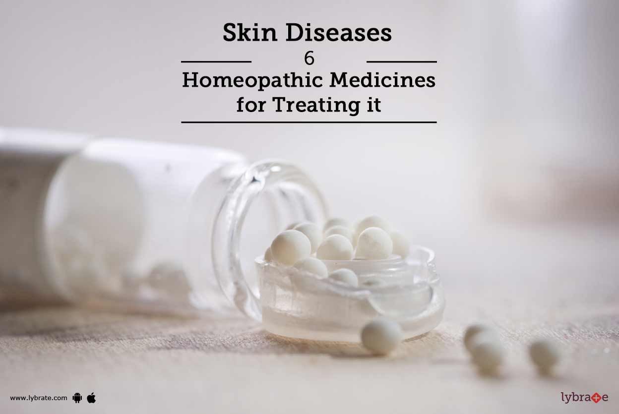 Skin Diseases - 6 Homeopathic Medicines for Treating it