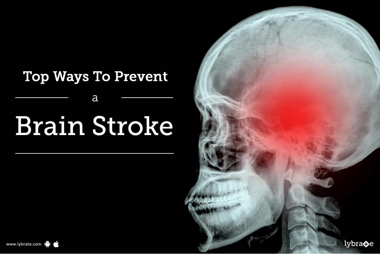 Top Ways To Prevent A Brain Stroke
