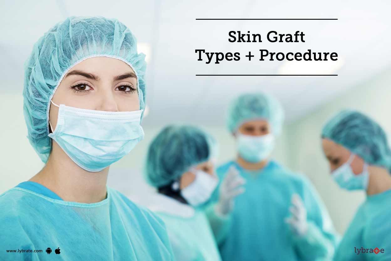 Skin Graft - Types + Procedure