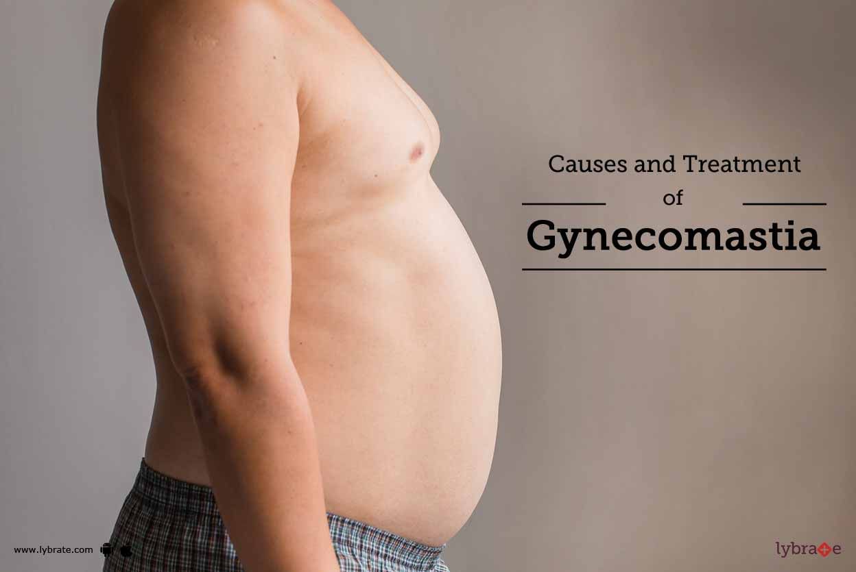 Causes and Treatment of Gynecomastia
