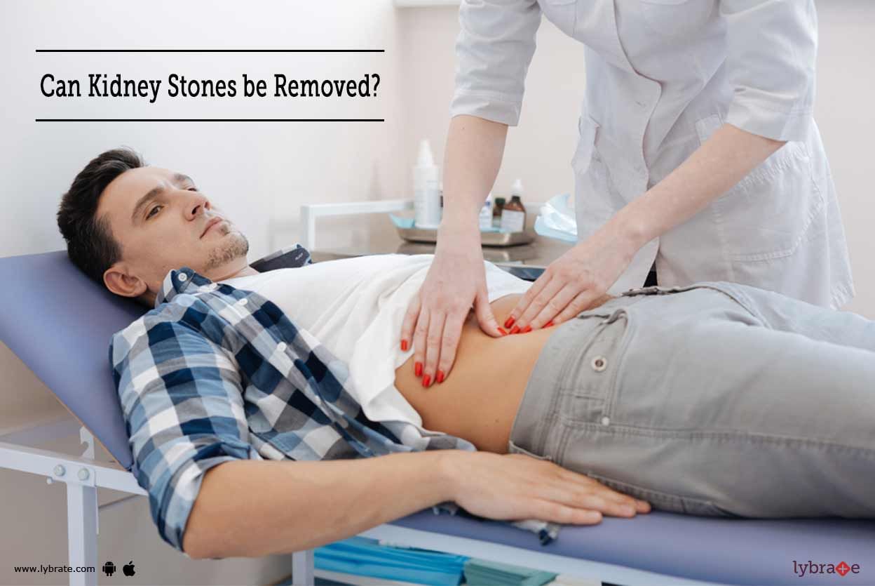 Can Kidney Stones be Removed?