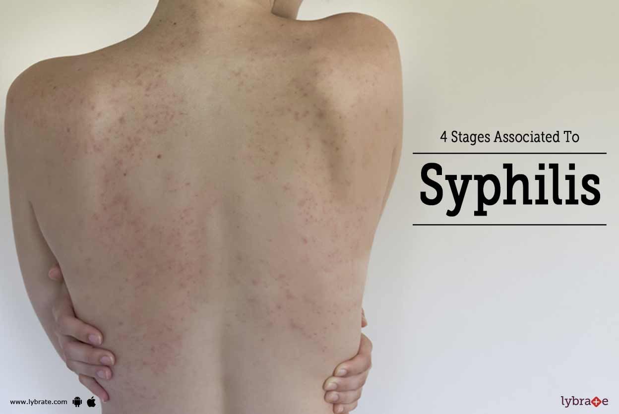 4 Stages Associated To Syphilis