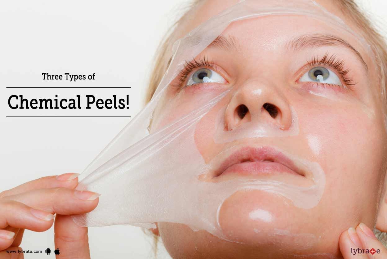 Three Types Of Chemical Peels!