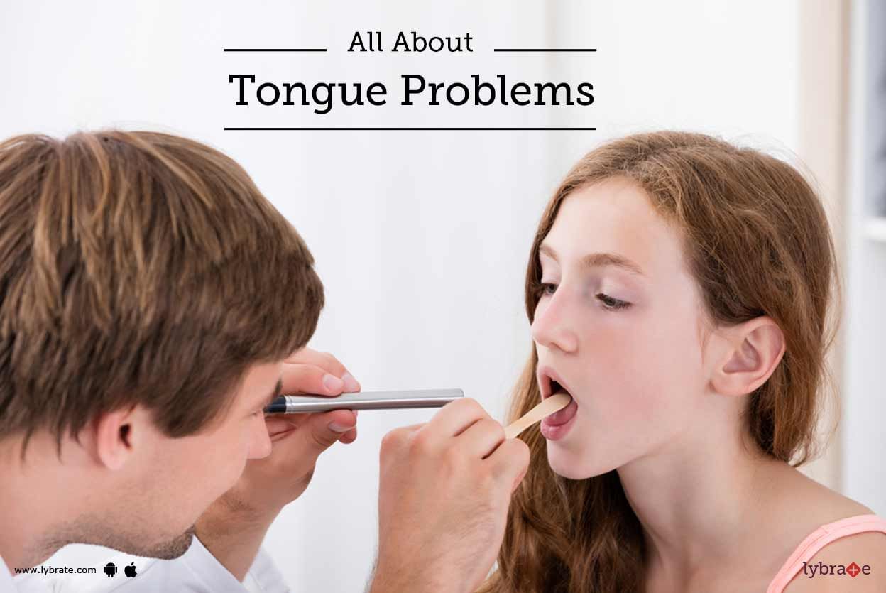 All About Tongue Problems