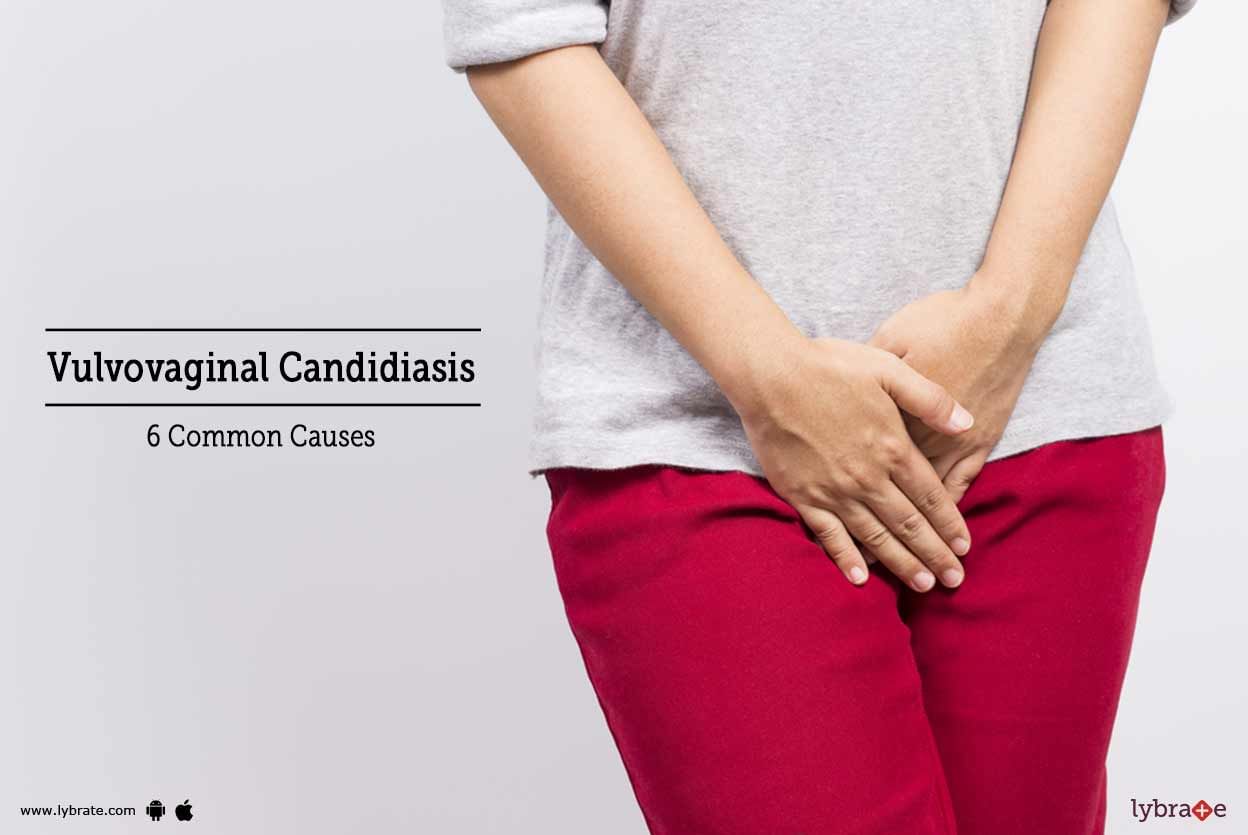 Vulvovaginal Candidiasis - 6 Common Causes