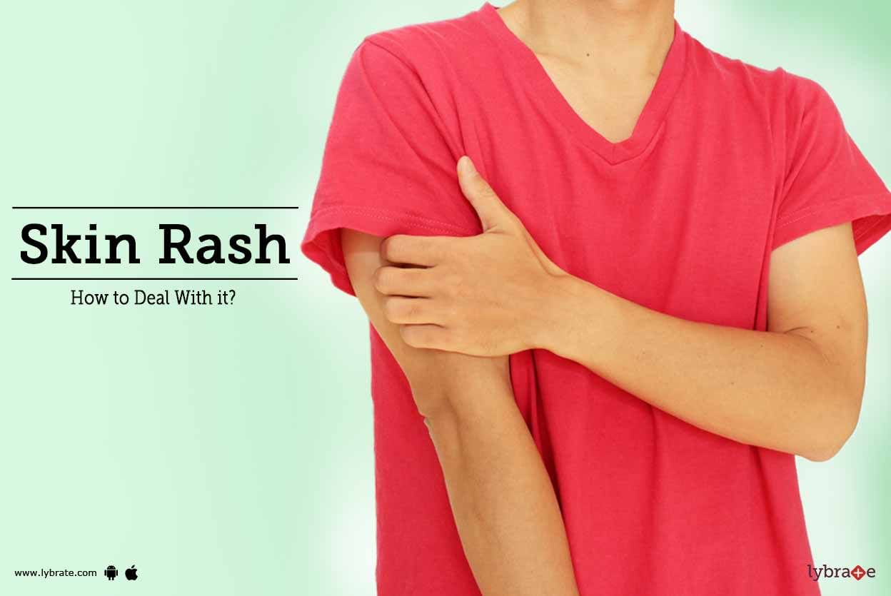 Skin Rash: How to Deal With it?