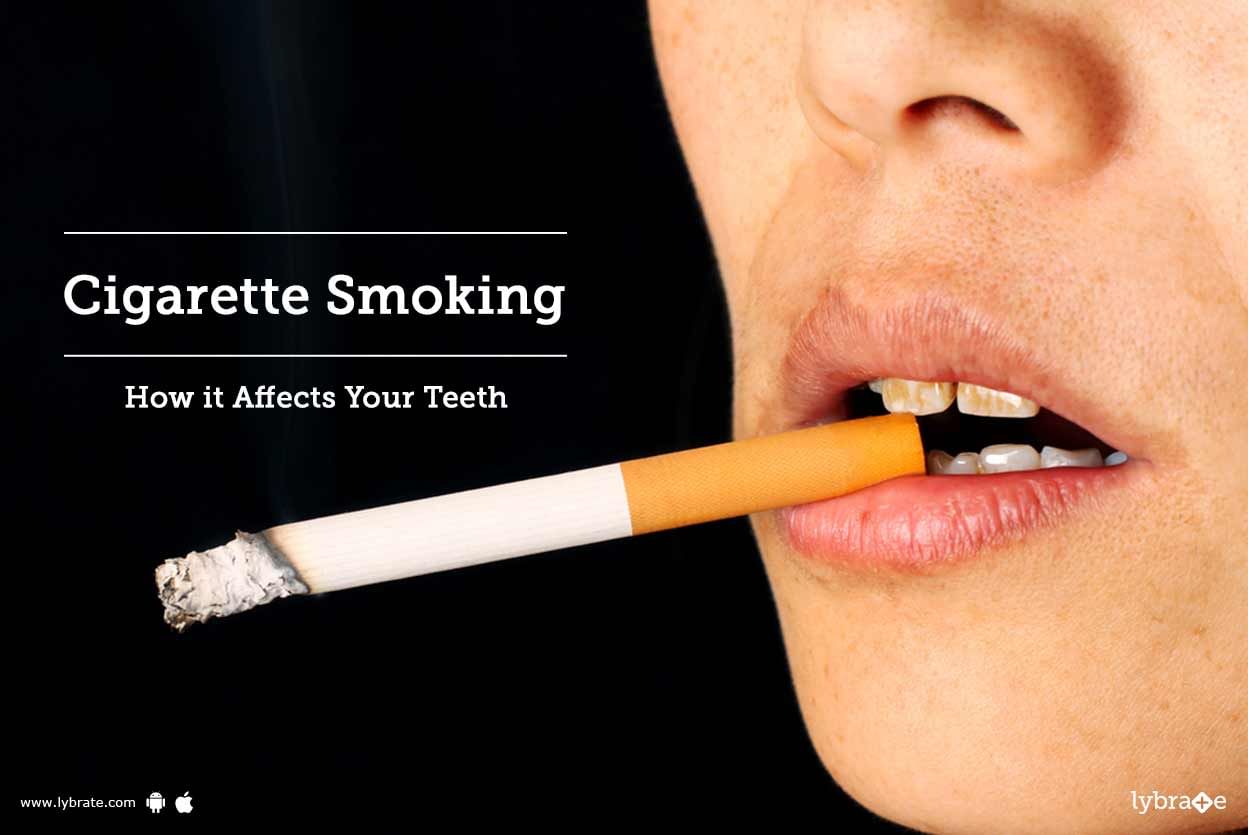 Cigarette Smoking -  How it Affects Your Teeth