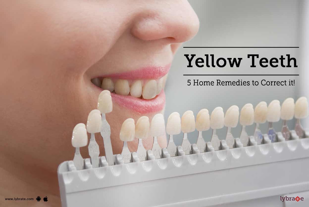Yellow Teeth - 5 Home Remedies to Correct it!