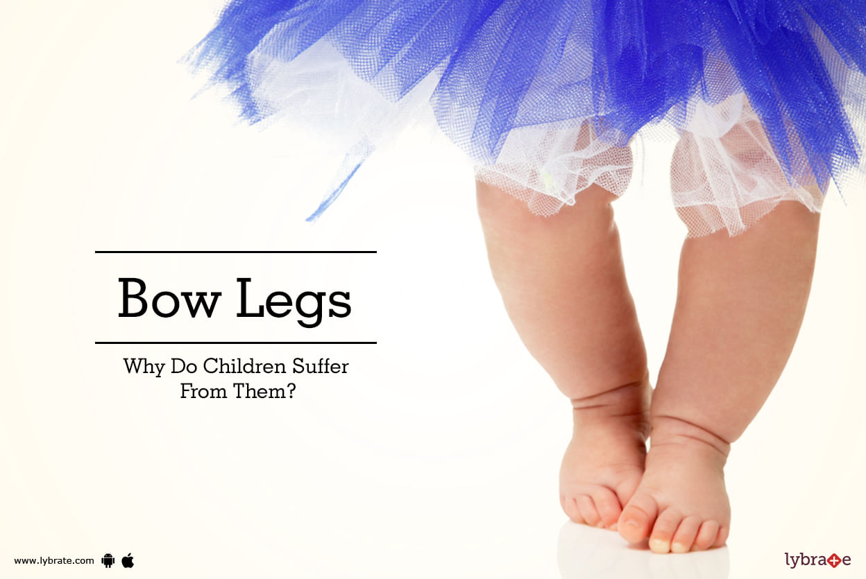 Bow Legs - Why Do Children Suffer From Them?