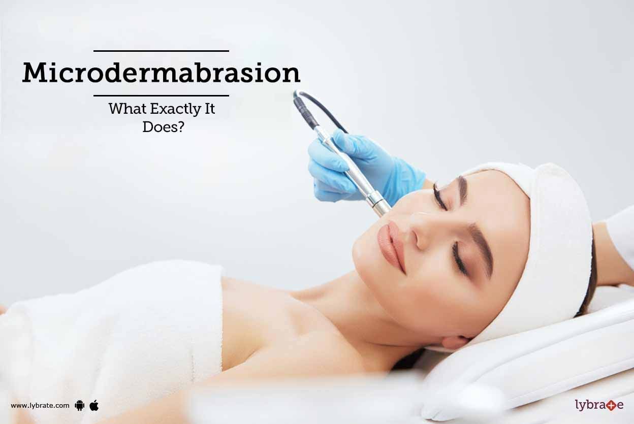 Microdermabrasion - What Exactly It Does?