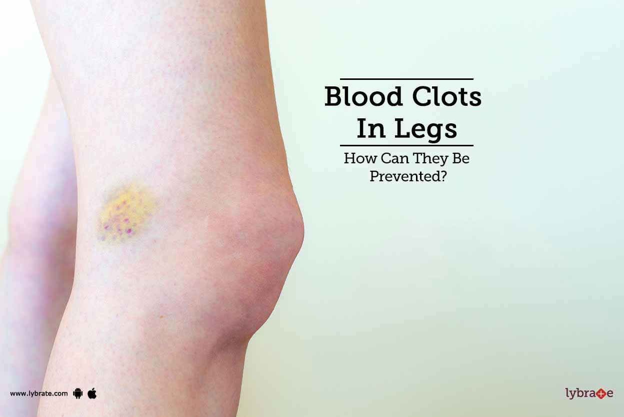 Blood Clots In Legs- How Can They Be Prevented?