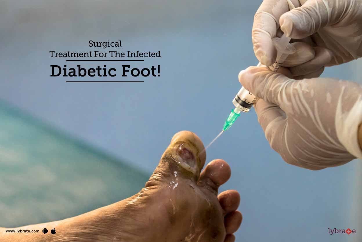 Surgical Treatment For The Infected Diabetic Foot!