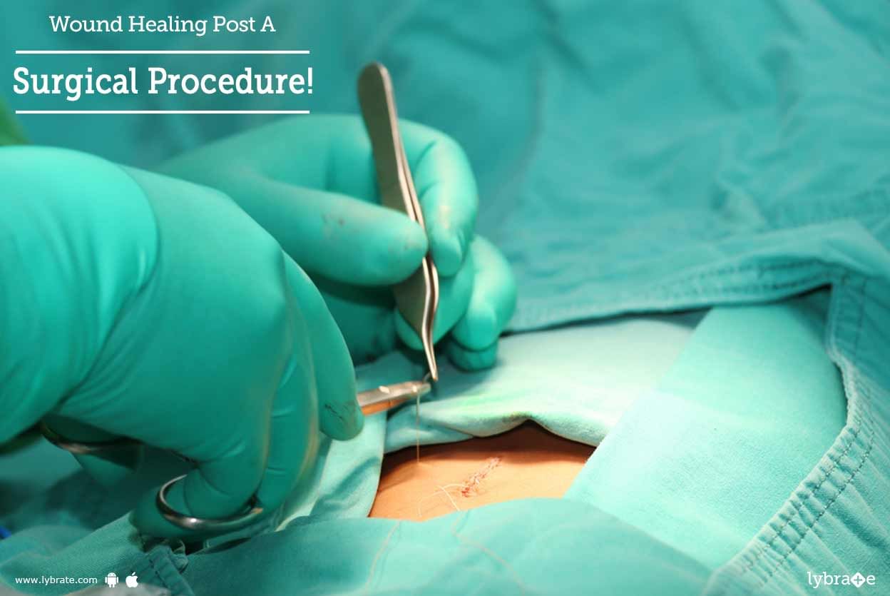 Wound Healing Post A Surgical Procedure!