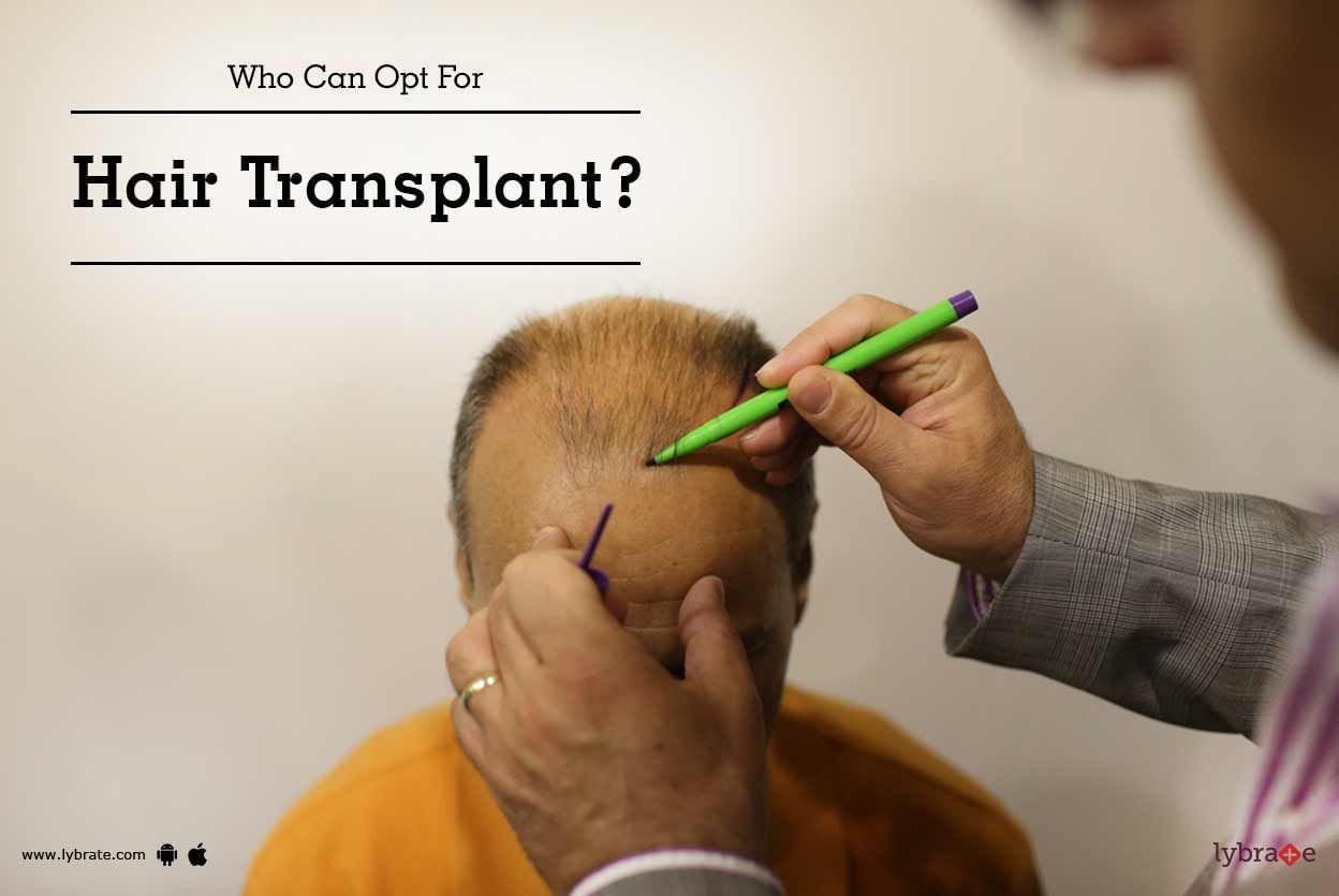 Who Can Opt For Hair Transplant?