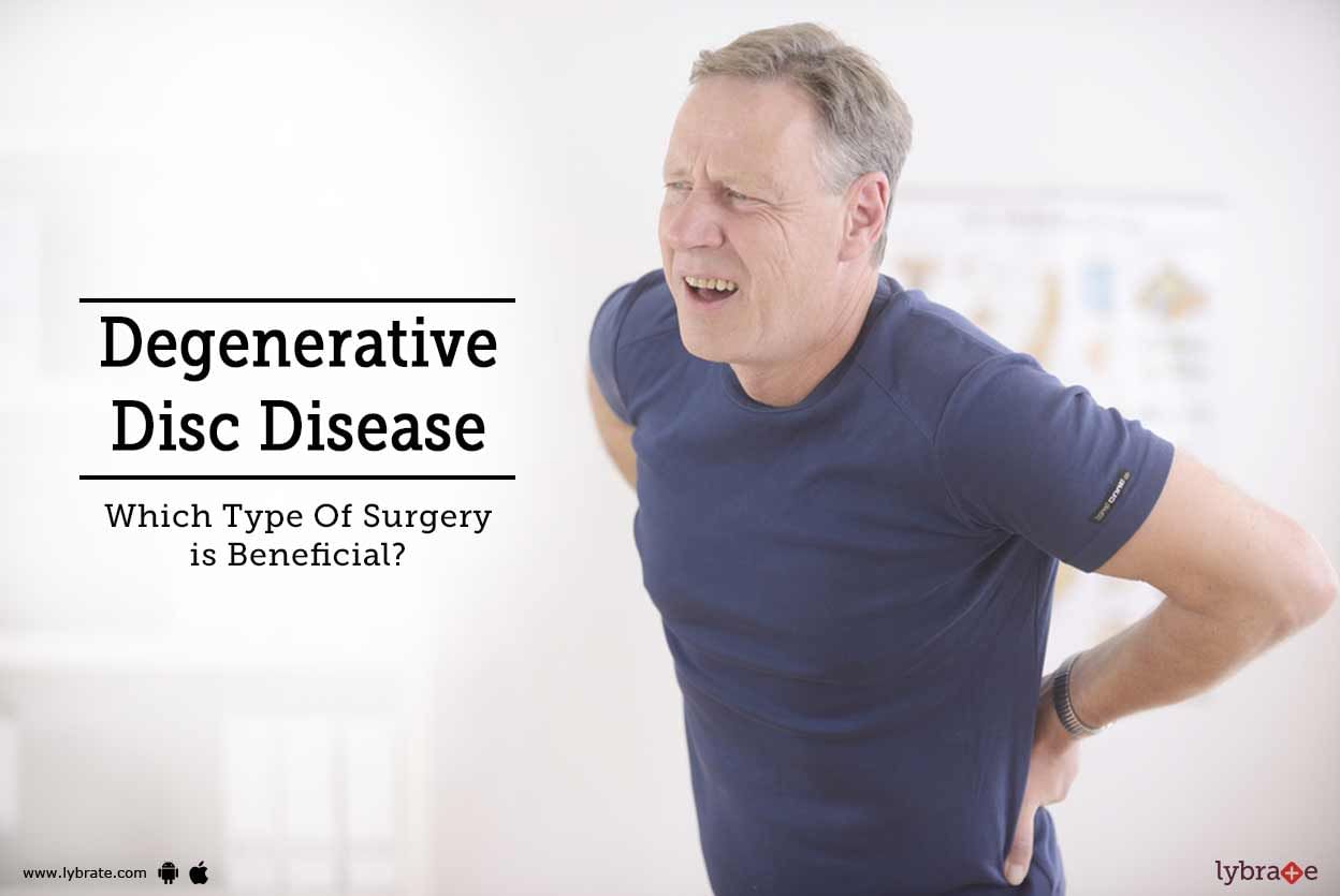Degenerative Disc Disease - Which Type Of Surgery is Beneficial?