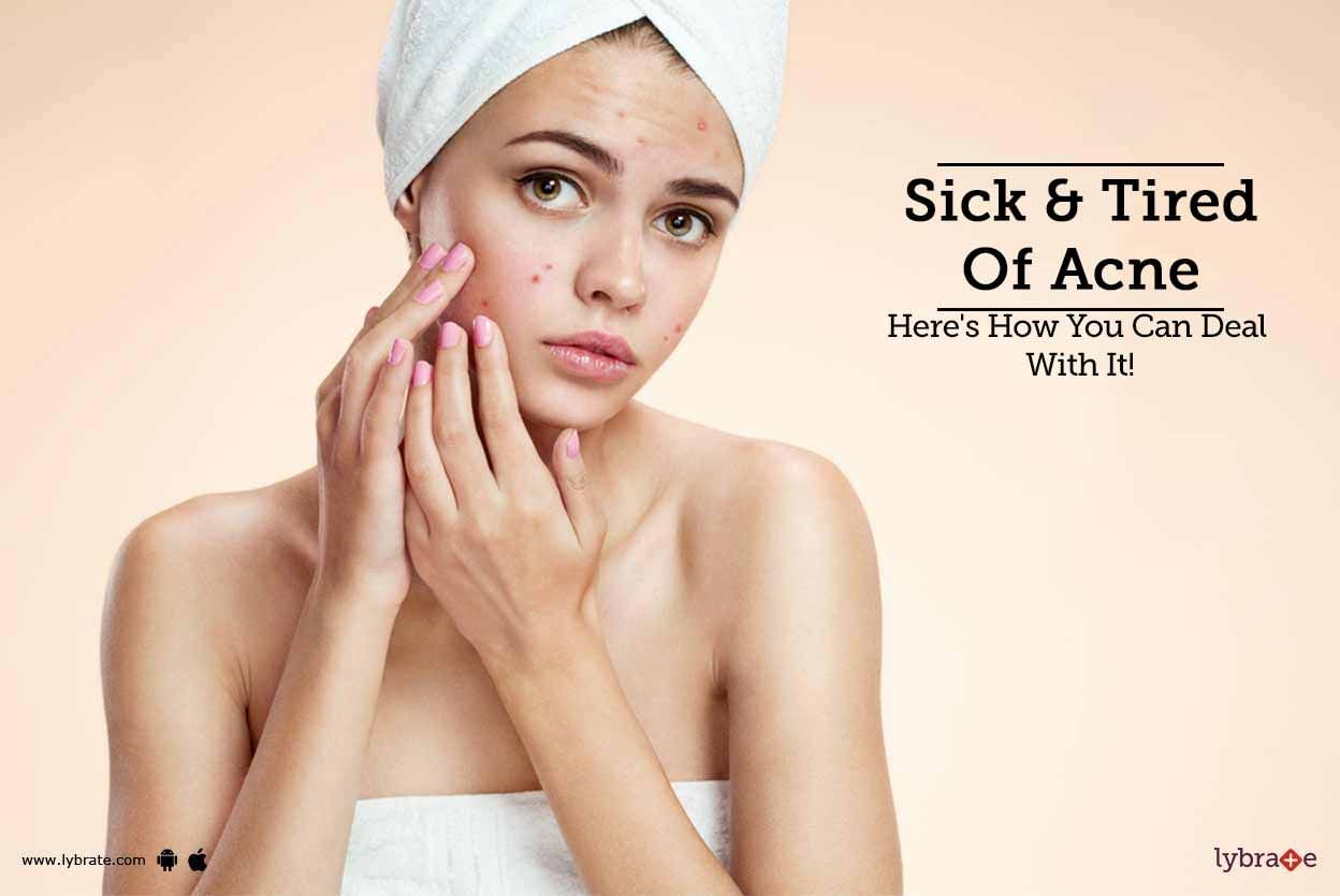 Sick & Tired Of Acne - Here's How You Can Deal With It!