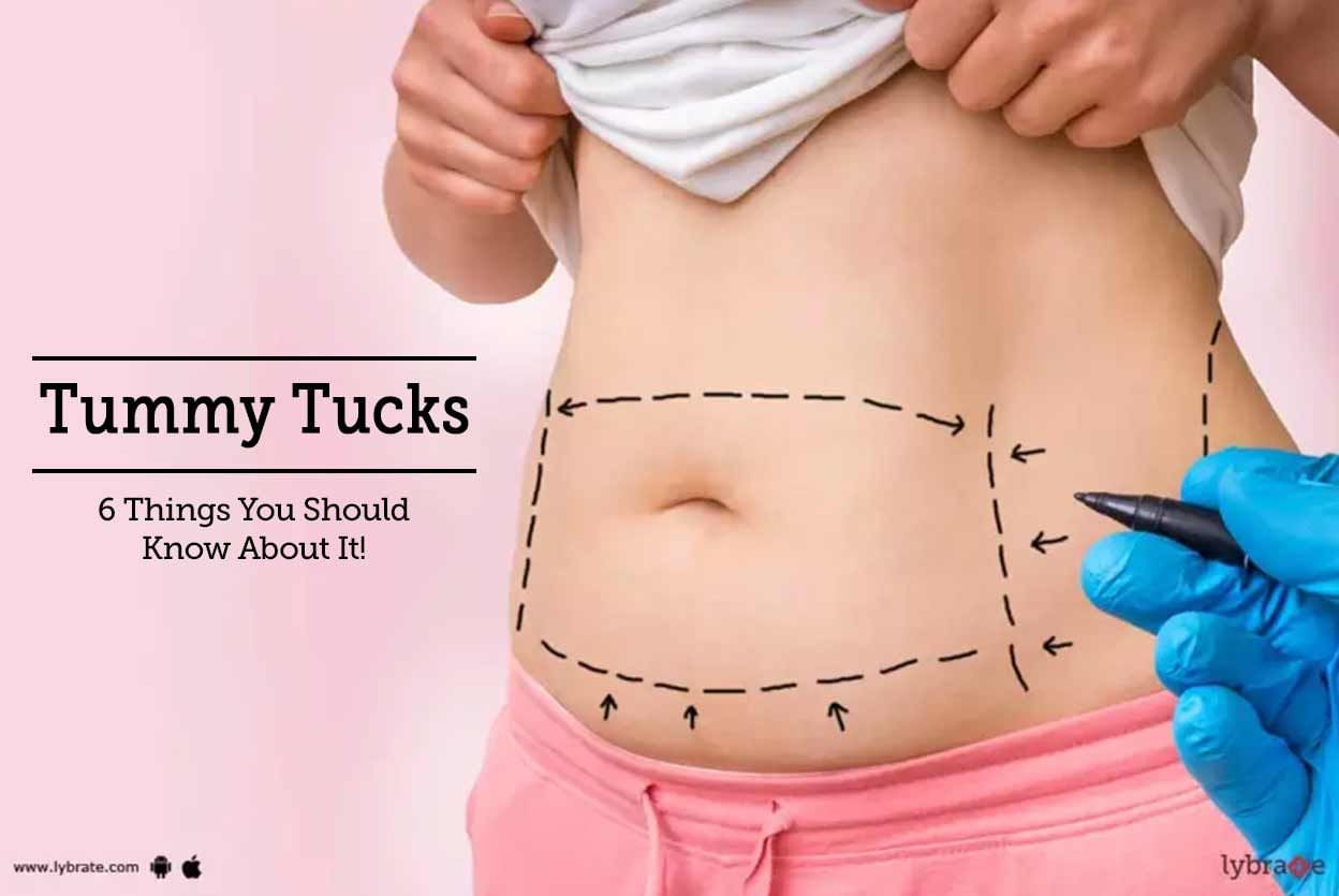 Tummy Tucks - 6 Things You Should Know About It!