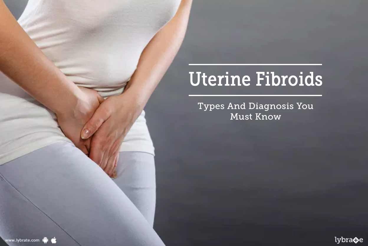 Uterine Fibroids - Types And Diagnosis You Must Know