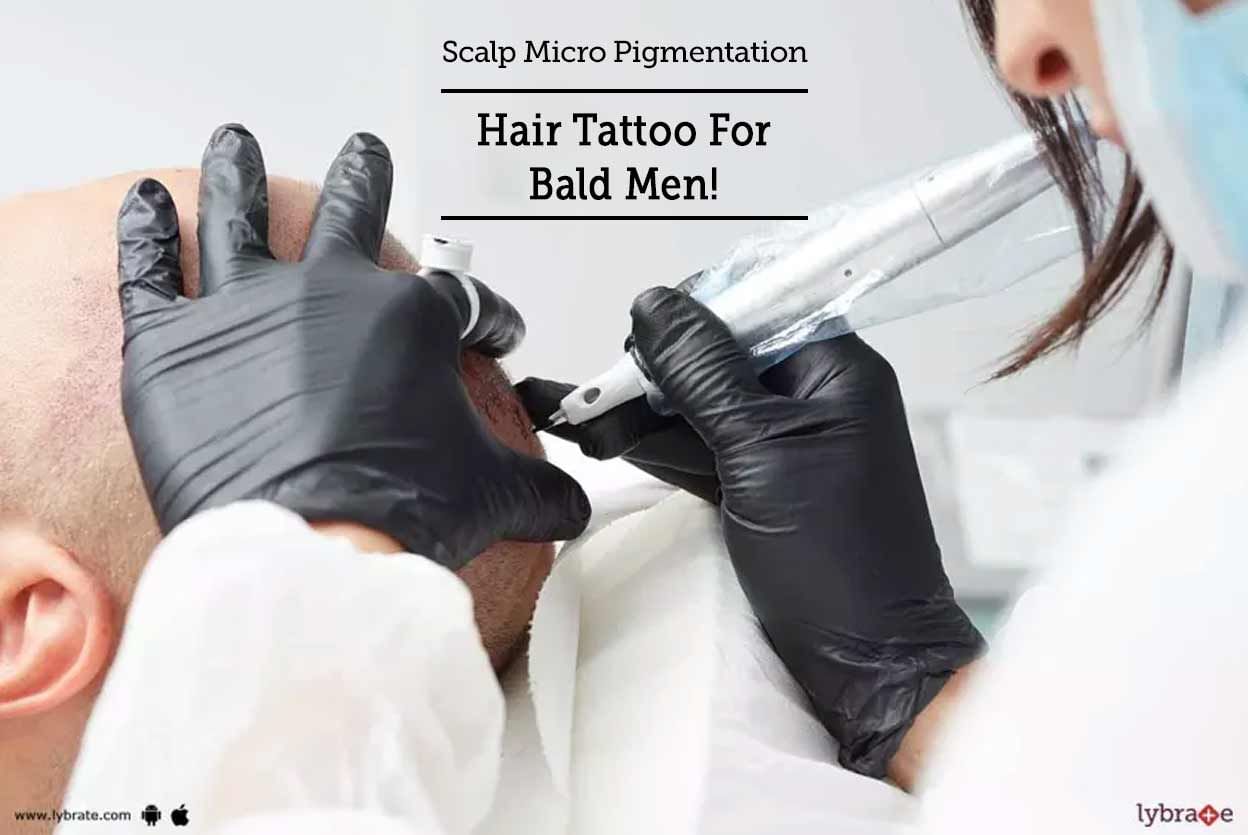Scalp Micro Pigmentation - Hair Tattoo For Bald Men!