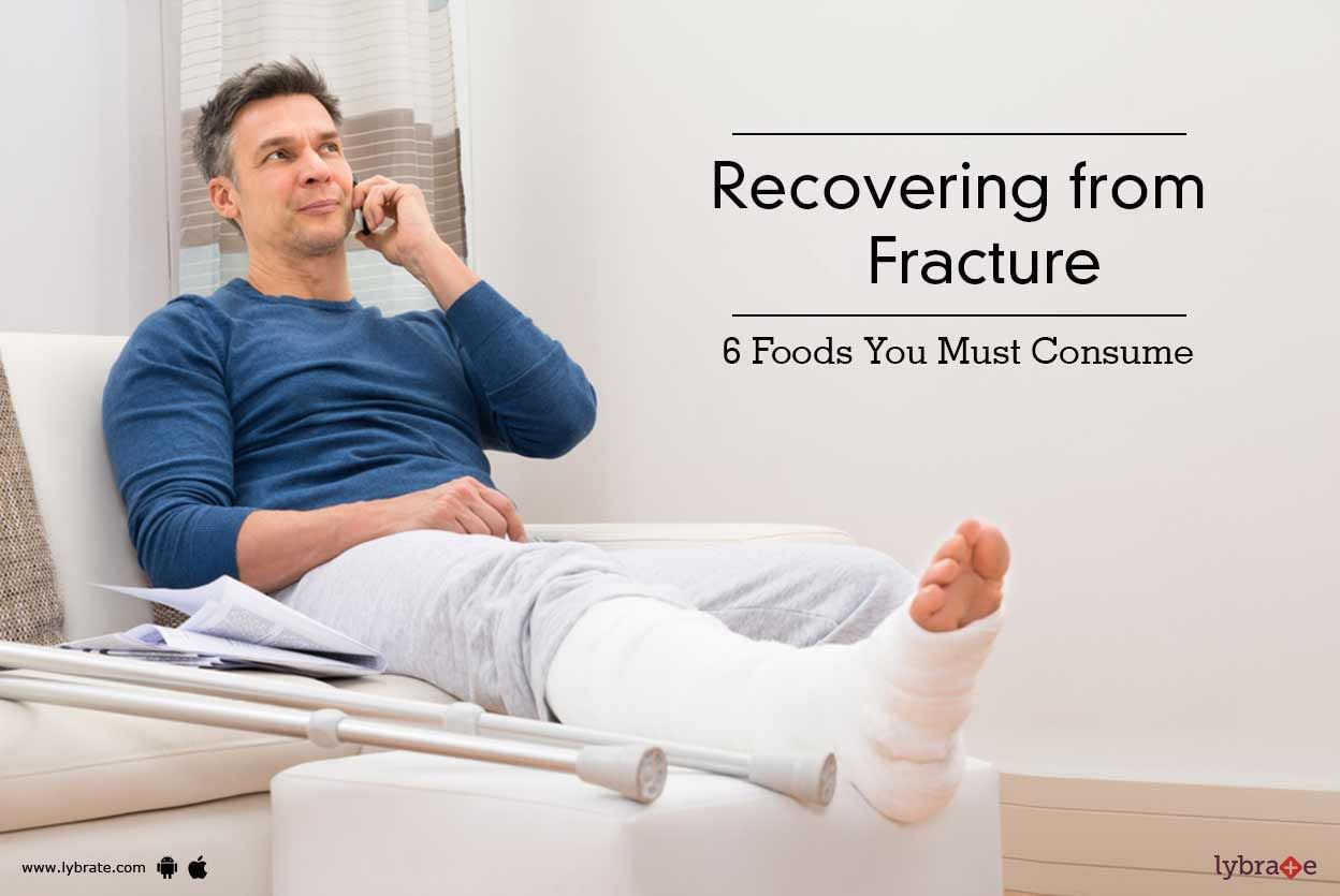 Recovering from Fracture - 6 Foods You Must Consume - By Dt. Sonal ...