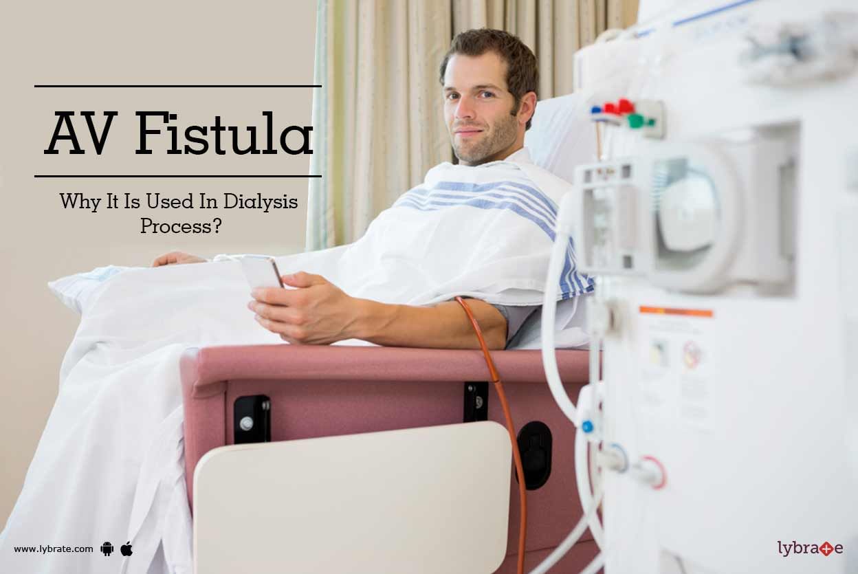AV Fistula - Why It Is Used In Dialysis Process?