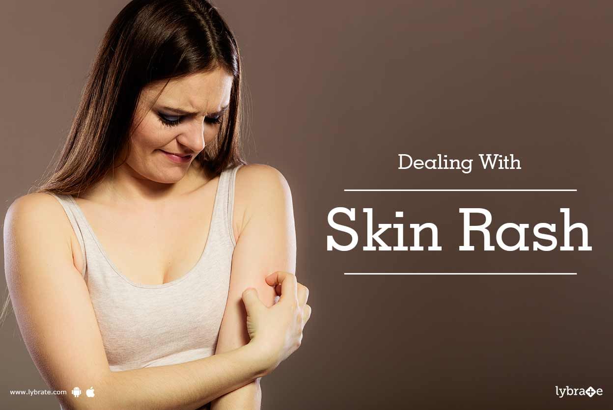 Dealing With Skin Rash