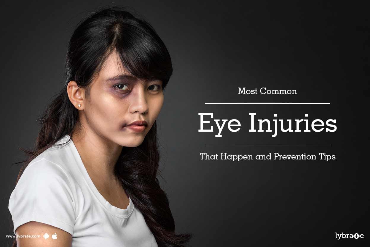 Most Common Eye Injuries That Happen and Prevention Tips
