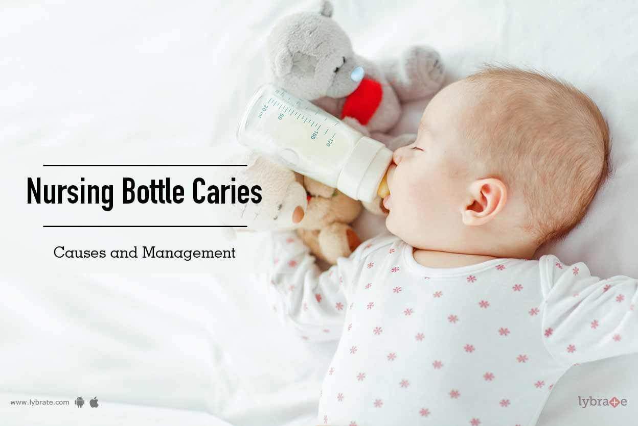 Nursing Bottle Caries- Causes and Management