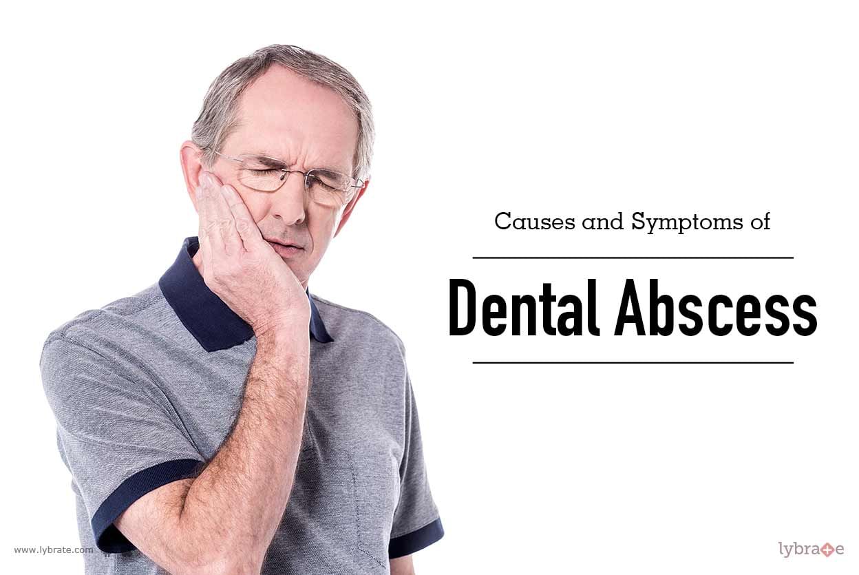 Causes and Symptoms of Dental Abscess