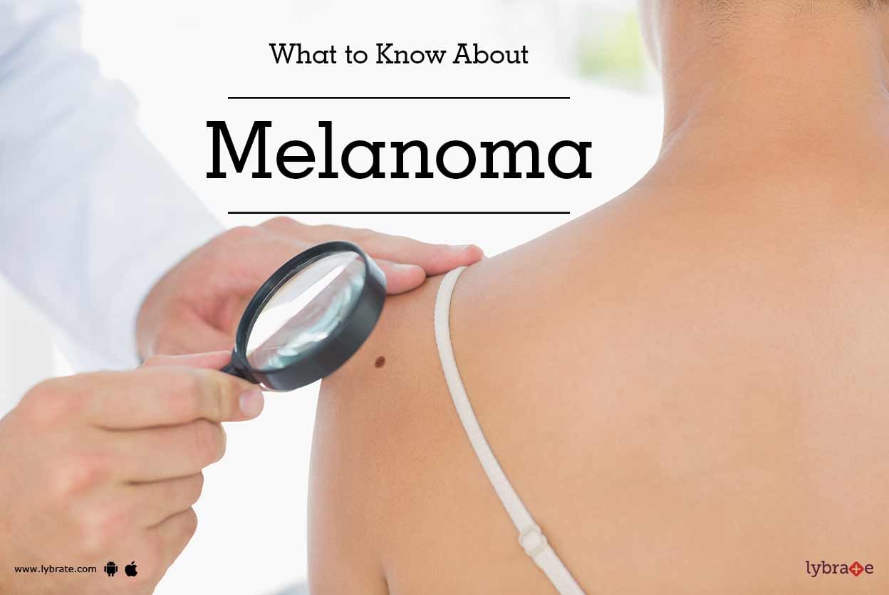 What to Know About Melanoma