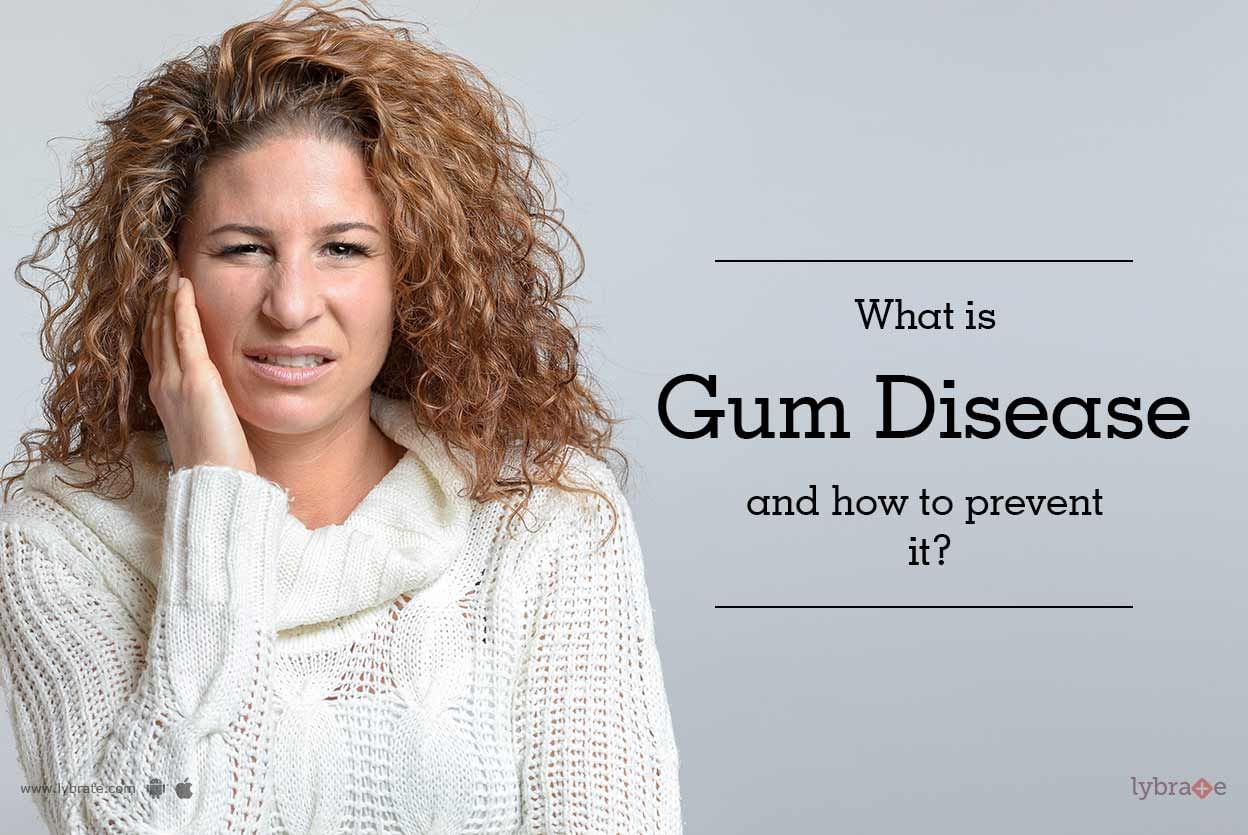 What Is Gum Disease and How to Prevent It?