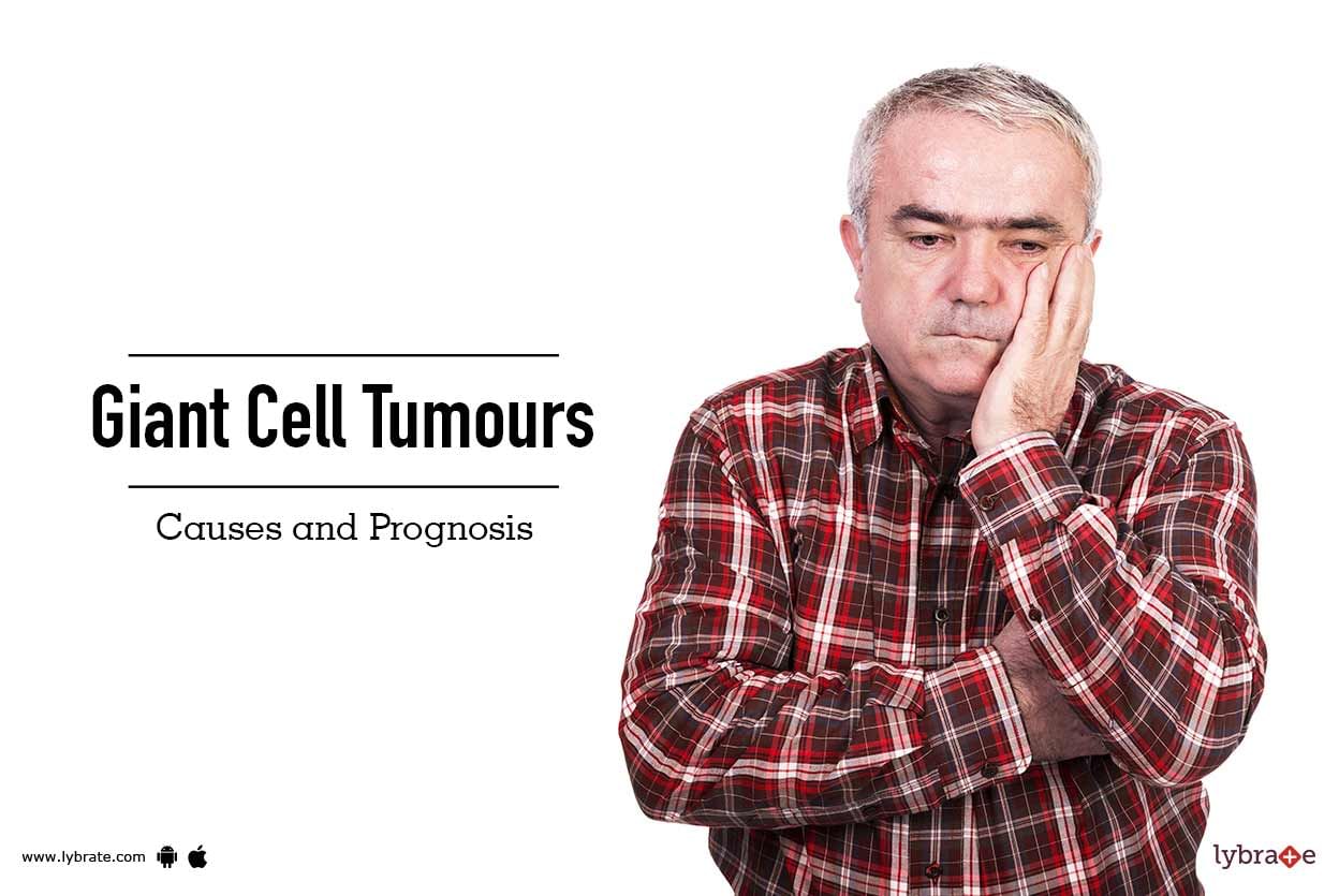 Giant Cell Tumours: Causes and Prognosis