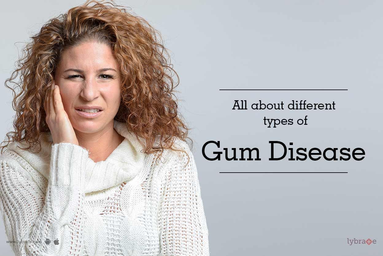 All About Different Types of Gum Disease
