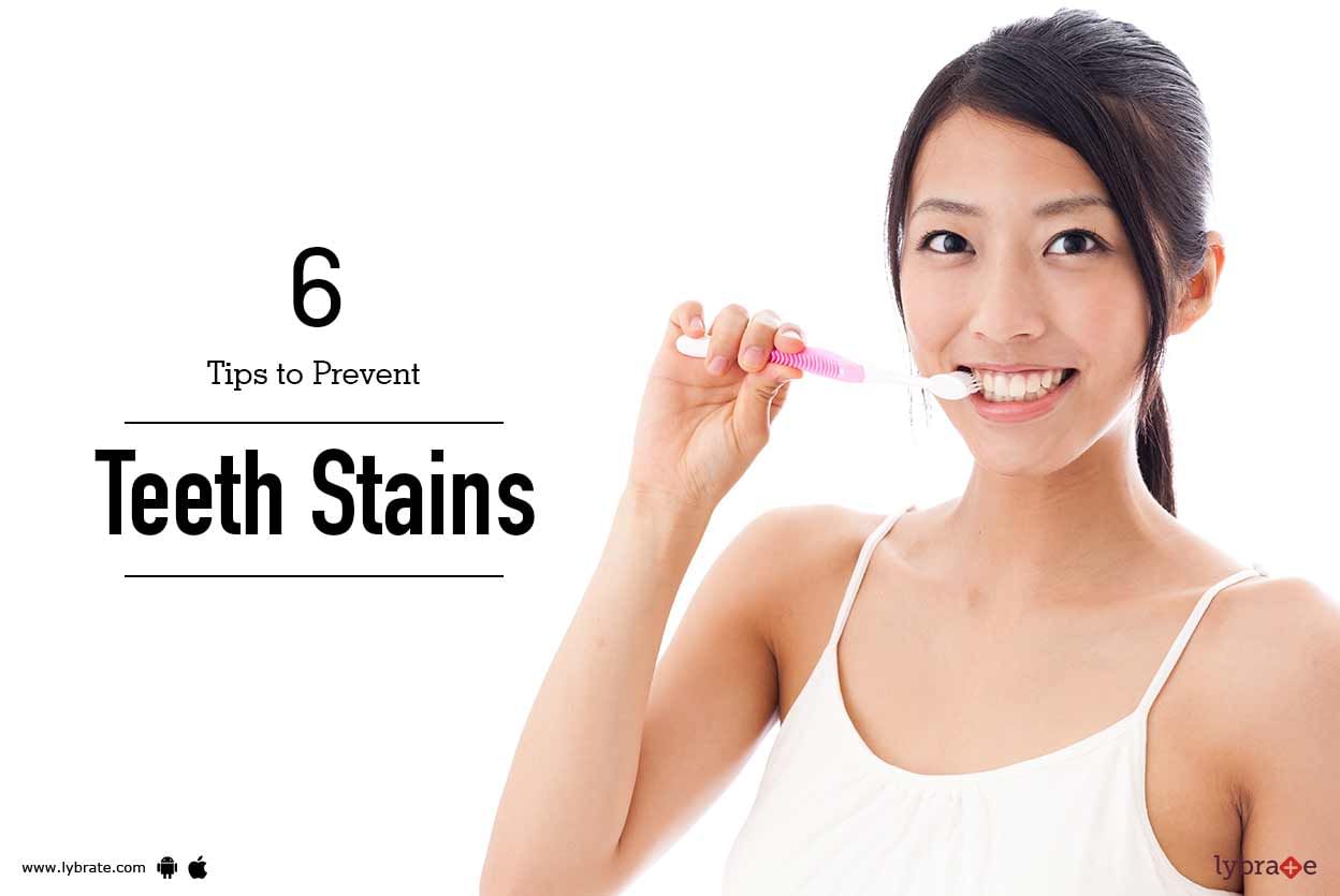 6 Tips to Prevent Teeth Stains