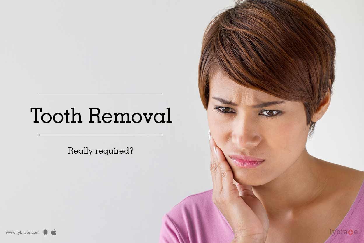 Tooth Removal - Really Required?