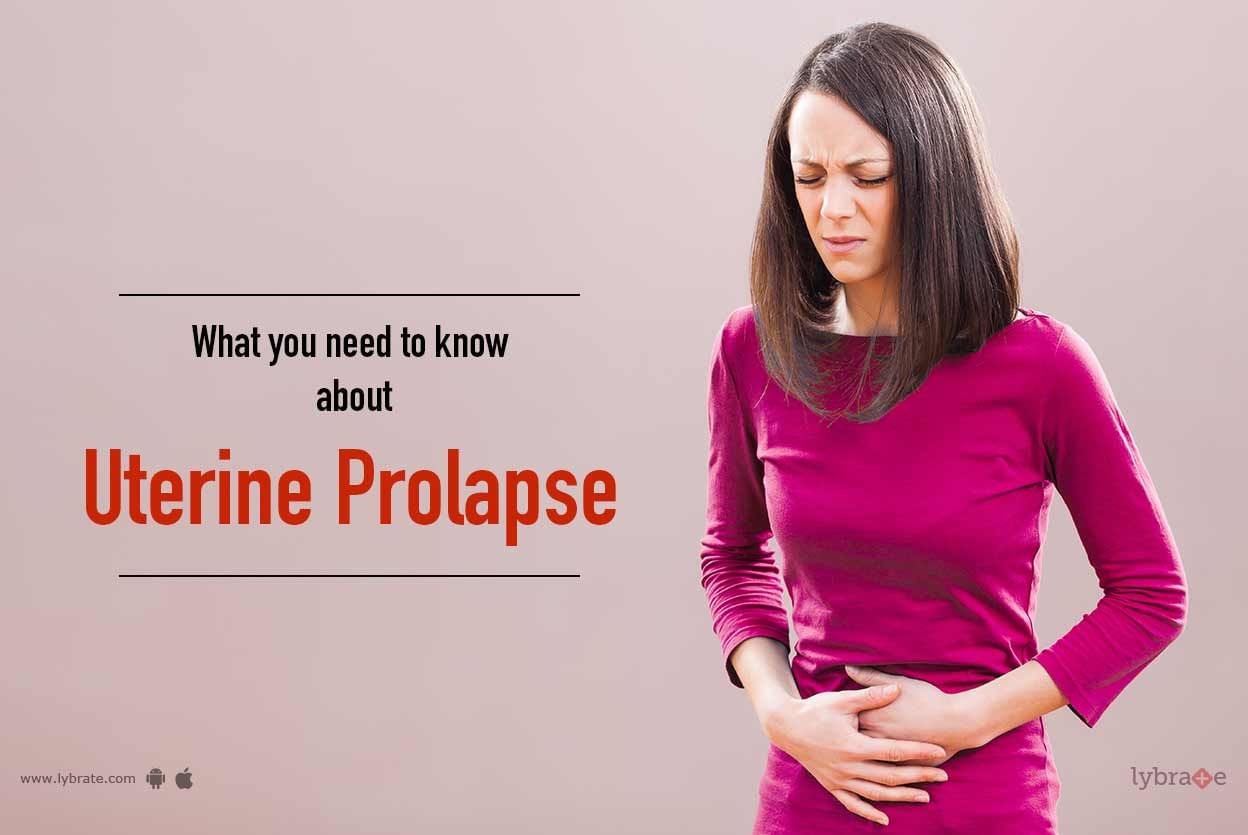 What You Need To Know About Uterine Prolapse