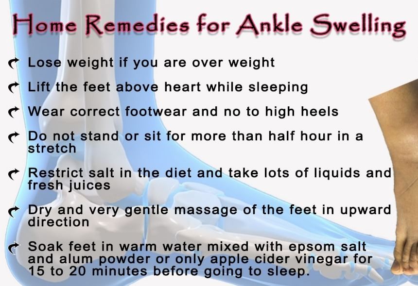 Herbal Remedies For Ankle Swelling!