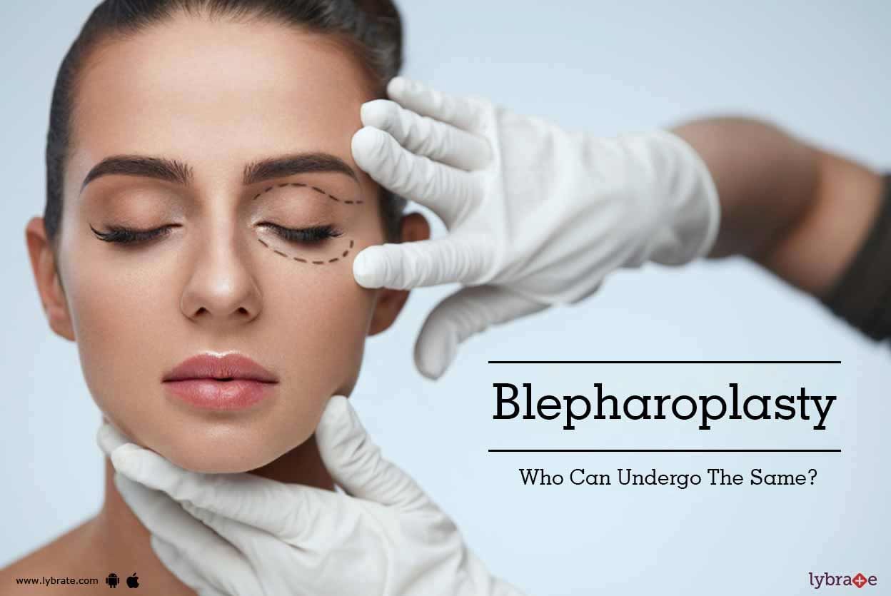 Blepharoplasty - Who Can Undergo The Same?