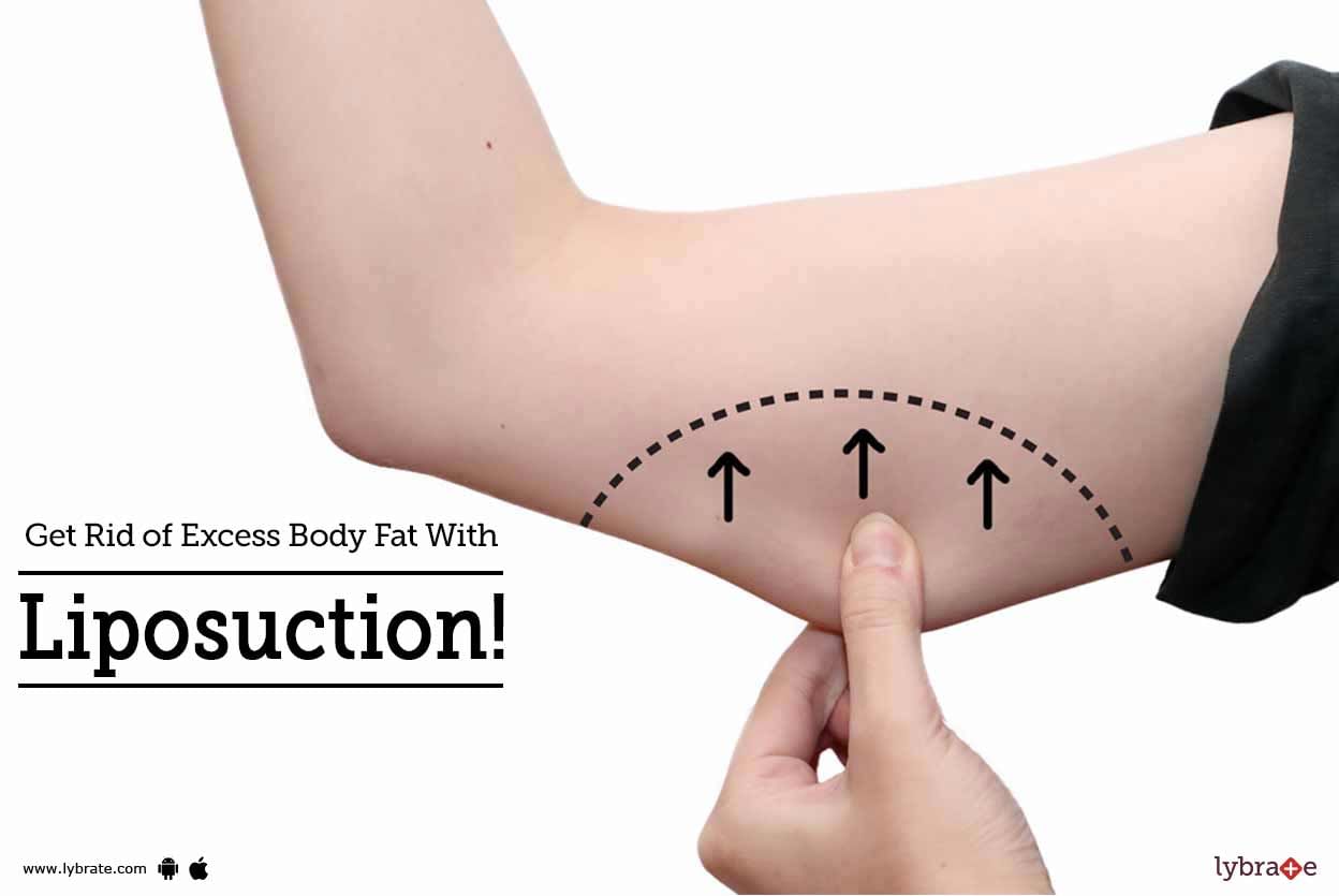 Get Rid of Excess Body Fat With Liposuction!