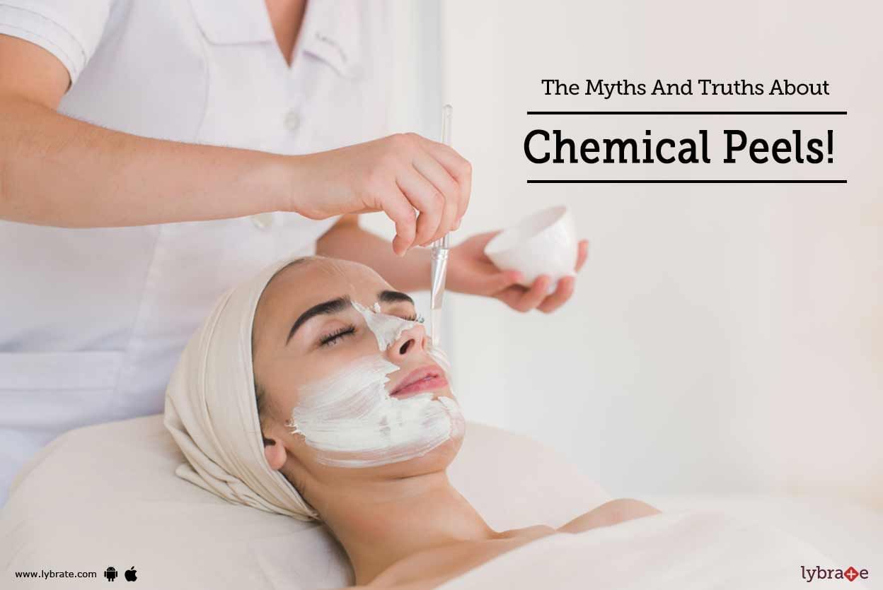The Myths And Truths About Chemical Peels!