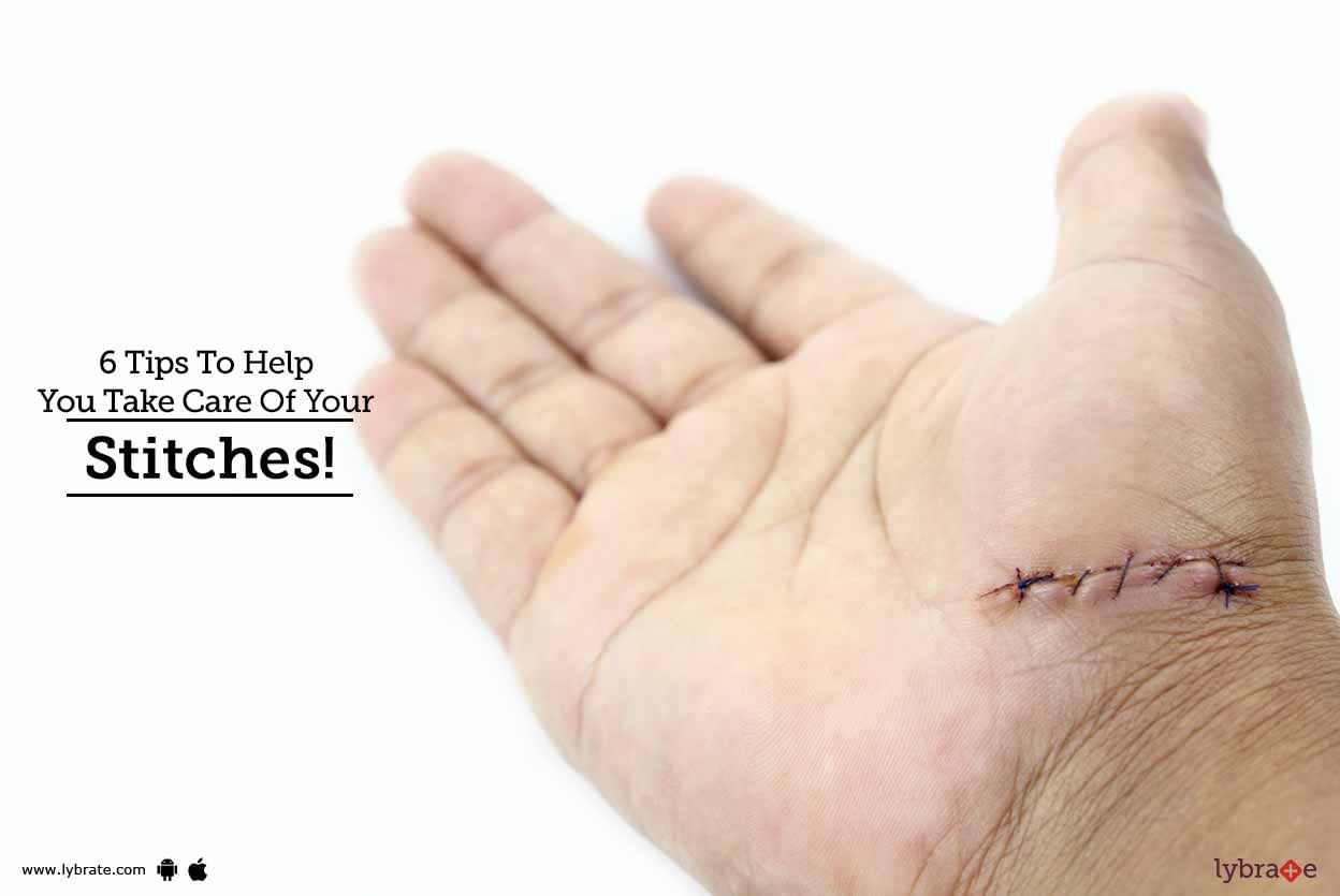 6 Tips To Help You Take Care Of Your Stitches!