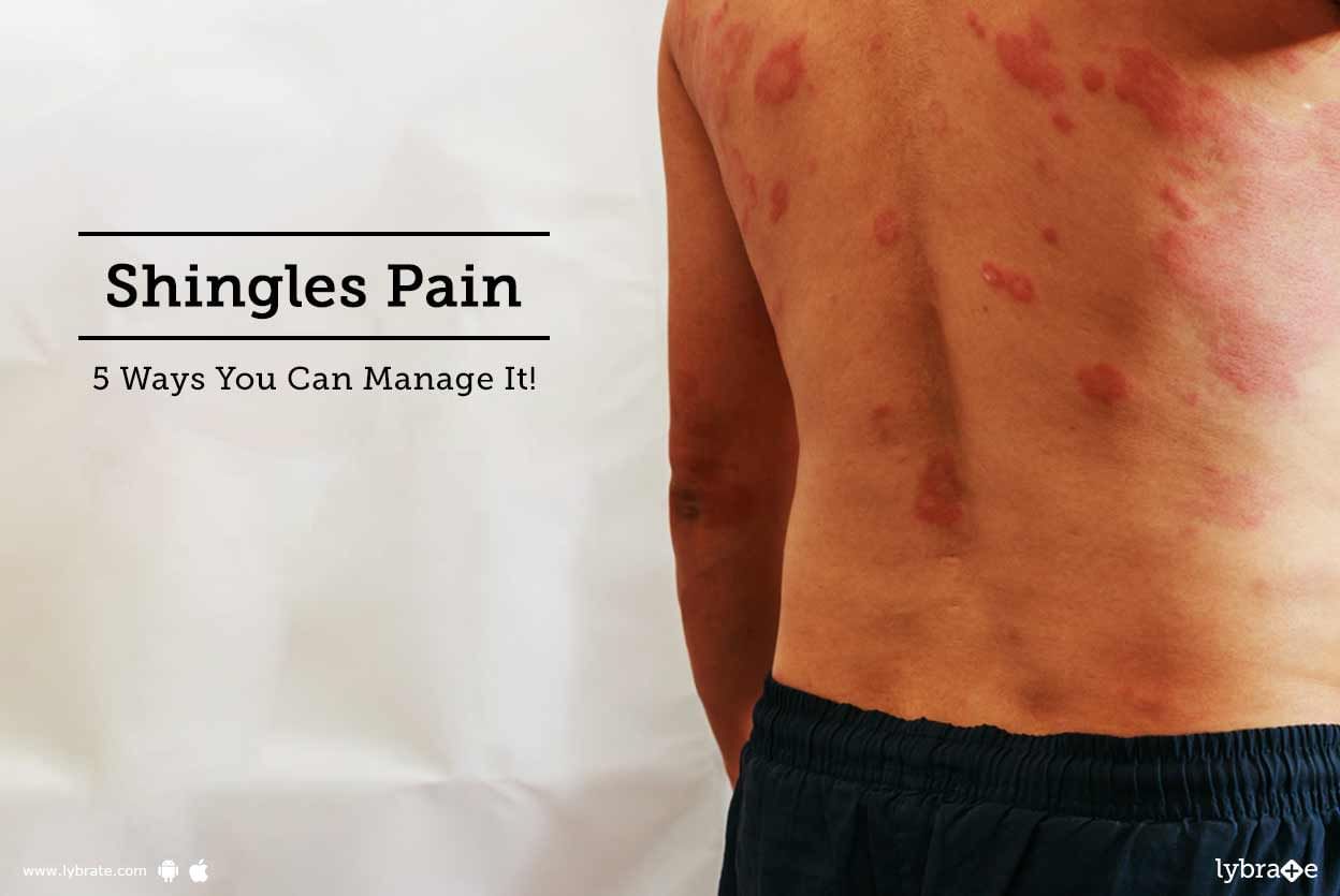 Shingles Pain - 5 Ways You Can Manage It!