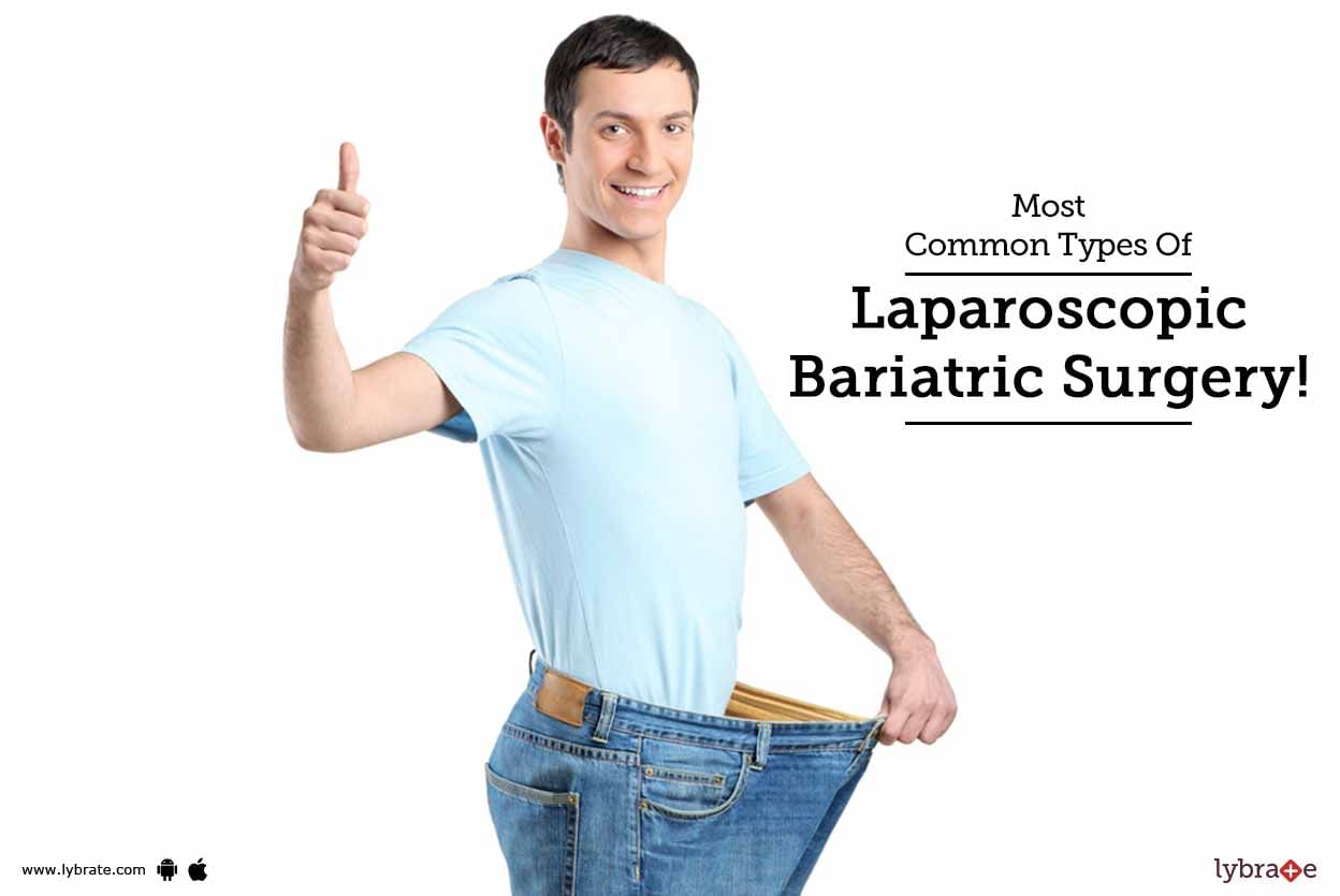 Most Common Types Of Laparoscopic Bariatric Surgery!